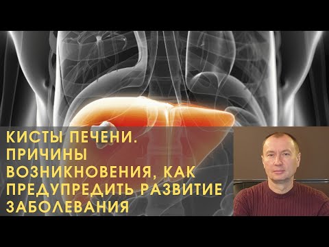 КИСТЫ ПЕЧЕНИ. ПРИЧИНЫ ВОЗНИКНОВЕНИЯ, КАК ПРЕДУПРЕДИТЬ РАЗВИТИЕ ЗАБОЛЕВАНИЯ.