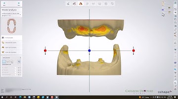 CUD-CLD with 2 Locator Abutment
