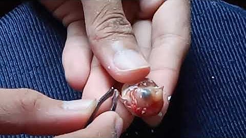 Saving a Chick From a Broken Egg Shell: Helping a Chick for Emergency Hatching PART 2