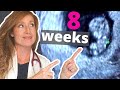 8 Week Ultrasound | PLUS how to Help with Morning Sickness