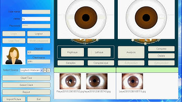 Iris scanner operate video