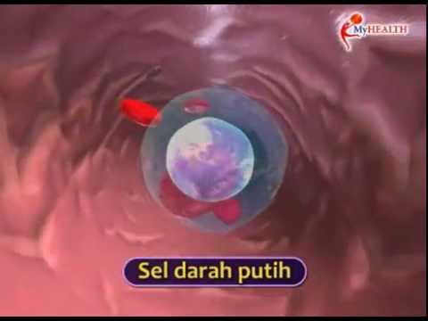 Video: Wanita Hamil Dengan Kembar Dan Memerangi Leukemia Membuat Permohonan Putus Asa Untuk Donor Sumsum Tulang