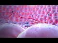 Ebola virus  mechanism of action  3d medical animation