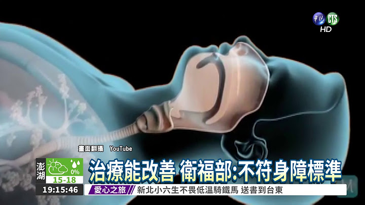 可改善! 睡眠呼吸中止症非身障 - 天天要闻