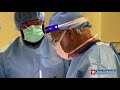 Total Knee Replacement Surgery with Dr. Taunton