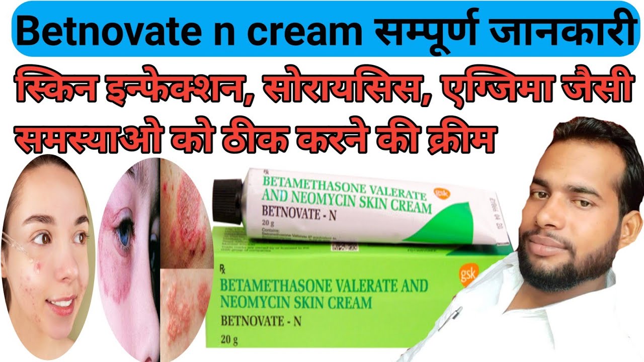 Betnovate n cream Betnovate n cream uses in Hindi Betnovate N