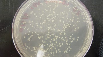 CFU: Colony Forming Unit & cfu/ml calculation