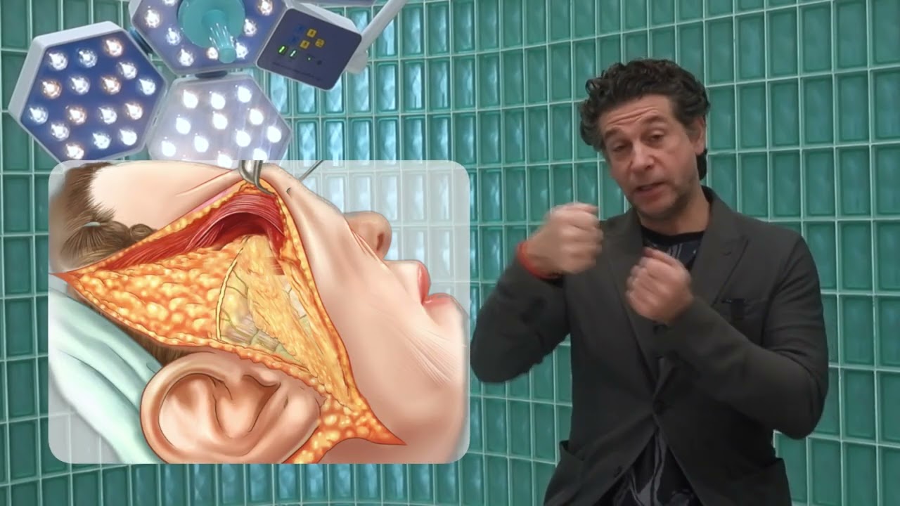 الأسئلة الأكثر شيوعاً خلال استشارة عملية شد الوجه مع د. عادل قطينه Facelift consultation FAQ