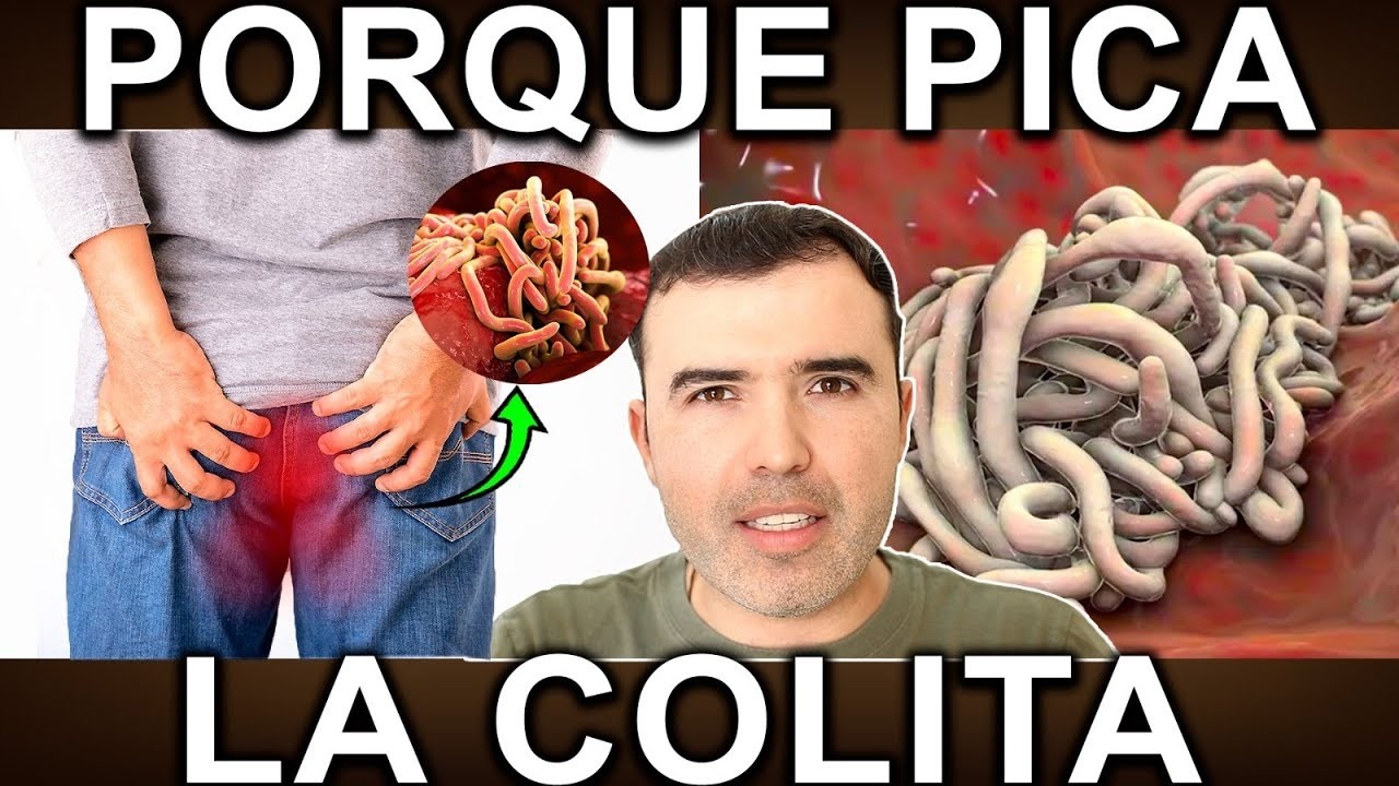 Pica el Ano? PORQUE PICA LA COLITA? - Elimina La Picazon En La Cola O Irritación Perianal