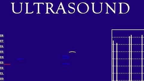 Duke Nukem 3D Grabbag Full Version Gravis Ultrasound Pro Patches Lite 1.61