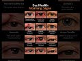 Eye Health Warning signs #eyehealth #health #medical #youtubeshorts #knowledge #shorts