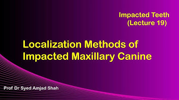 Localization Methods of Impacted Maxillary Canine | Oral & Maxillofacial Surgery | Syed Amjad Shah