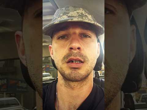 Shia LaBeouf Pulled Out His Own Tooth For A Movie Role