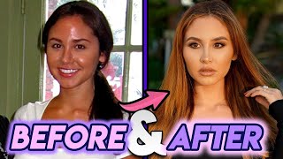 Catherine Paiz | Before and After Transformations | Plastic Surgery Transformation