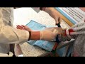 Взяття крові з вени за допомогою системи VacuTainer