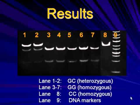 Association of IL-6 (-174) G/C Gene Polymorphism with Knee Osteoarthritis
