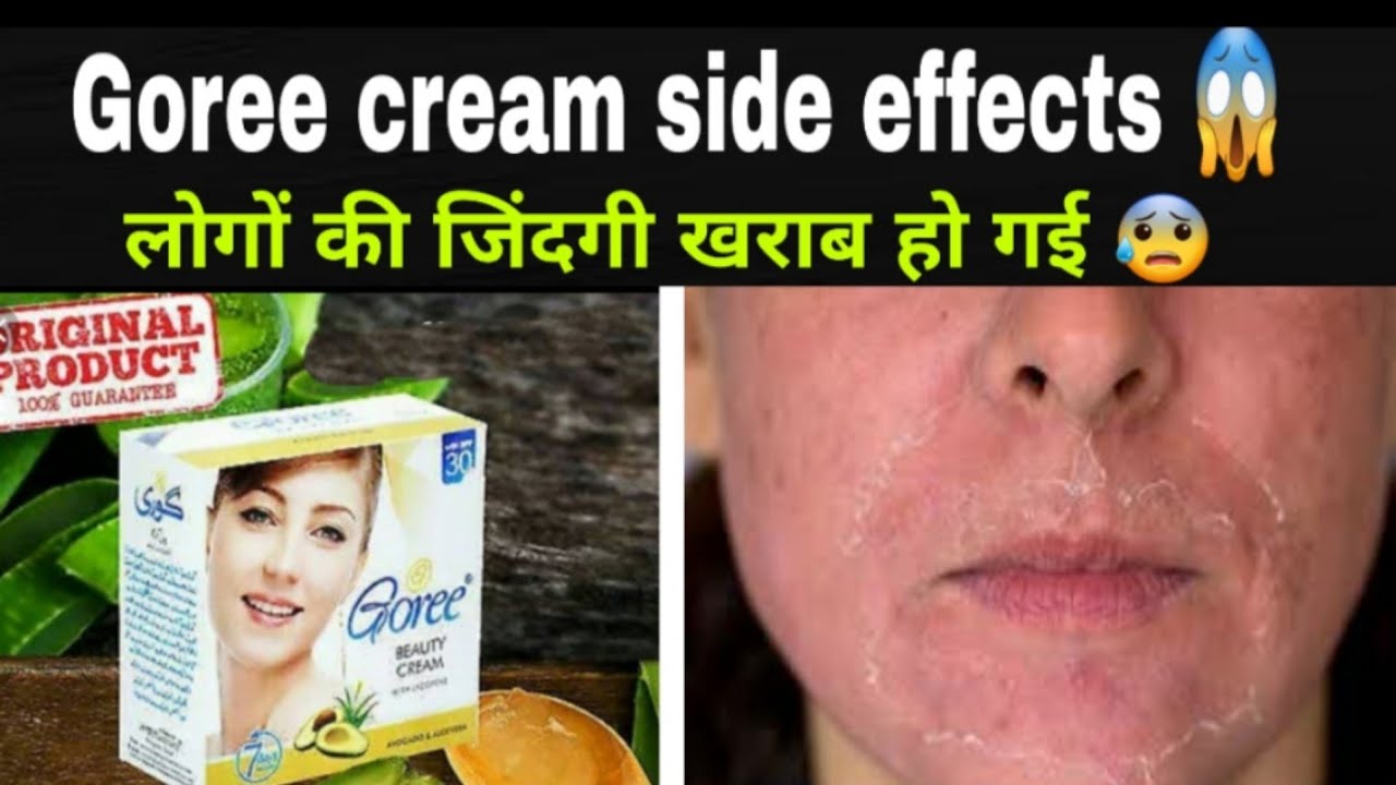 How to use Goree cream side effects, Acne pimple, fake goree