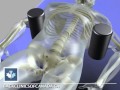 Sciatica | Spinal Decompression | Back Clinics of Canada