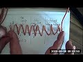 Difference between loop coil and solenoid