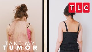 Alexandra Takes A Weight Off Her Back | Take My Tumor | TLC