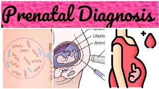 Prenatal Diagnosis