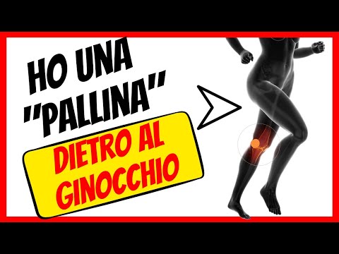 Video: Cisti Di Baker (poplitea): Cause, Sintomi E Diagnosi