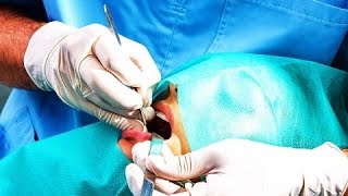 Teeth Can Heal Themselves With Stem Cells