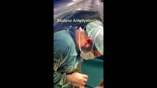 Skolyoz Bel Omurga Ameliyatı Beyin Ve Sinir Cerrahisi Doç Dr Ahmet Öğrenci