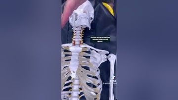Decompressing a Tension Pneumothorax