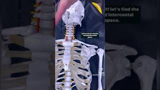 Decompressing a Tension Pneumothorax