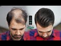 Hair Style For Very Thin & Balding Hair by using Hair Fibers 2022