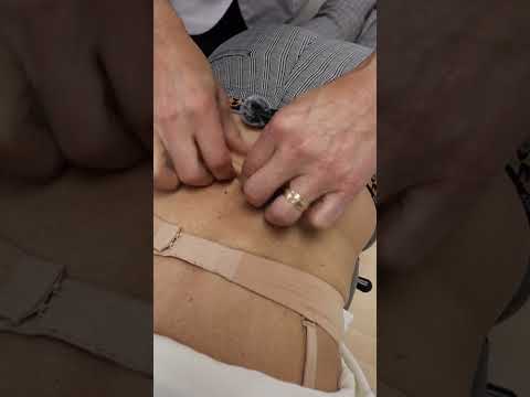 Low Back Skin Rolling To Remove Back Pain