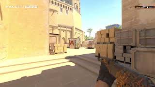 MrBiceps - Cs2 - Faceit Edit -