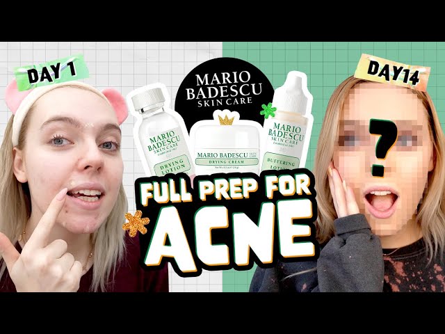 jøde lærer Beroligende middel Honest Review] 14 days WITH MARIO BADESCU Acne Repair Kit - YouTube