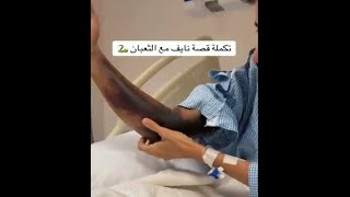 شاهد ماذا حدث ل هاوي صيد ثعابين بعدما لدغه ثعبان فجأة