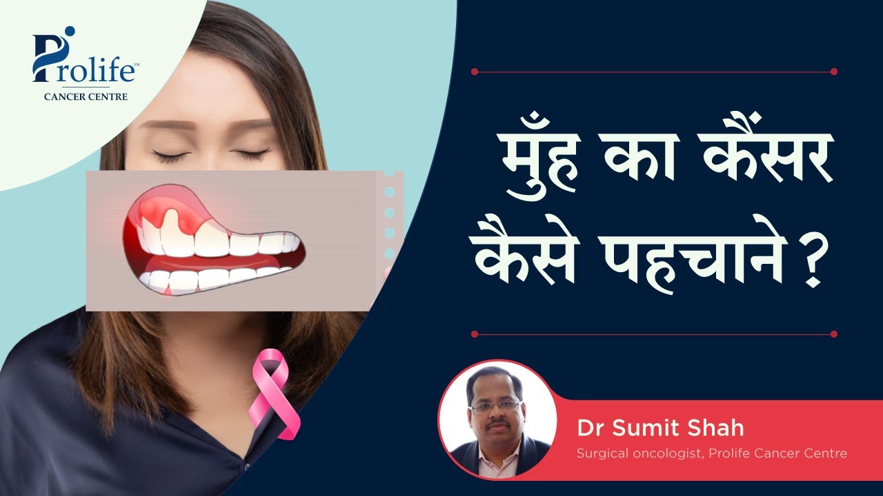 how-to-check-oral-cancer-at-home-dr