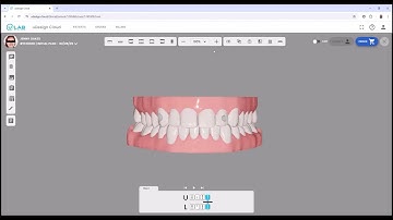 uDesign Cloud - uAssist case review and modifications