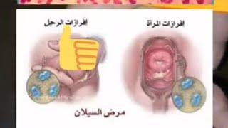 علاج مرض خطير عند الرجال بالاعشاب الطبيعية 0657890401