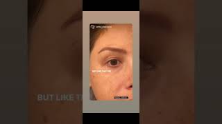 Healing Process of Microblading & Nano Brows