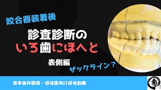 歯　補綴　模型　オールセラミック　サンプル　 標本 歯科医師　技工　インテリア 歯 補綴 模型 オールセラミック サンプル 標本 歯科医師 技工