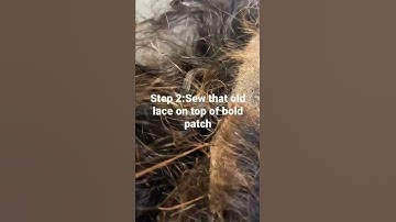 How to fix bald patch on lace frontal wigs #lacefrontwigs