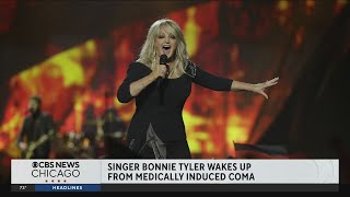 Singer Bonnie Taylor out of medically induced coma, family said in statement