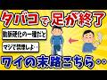 【悲惨】ヘビースモーカーワイ、血管が詰まって歩けなくなる‥【2ch風解説】