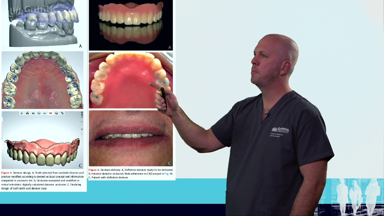 Clinical relevance of CAD/CAM surgery guide YouTube