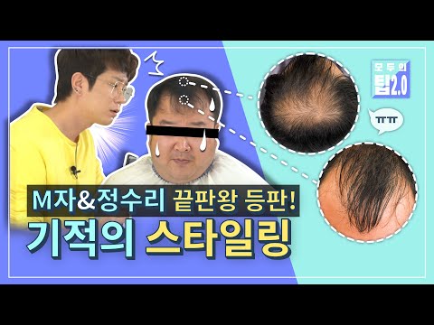 난이도 최상! M자&amp;amp;정수리 탈모 영혼까지 끌어모은 식스센스 스타일링