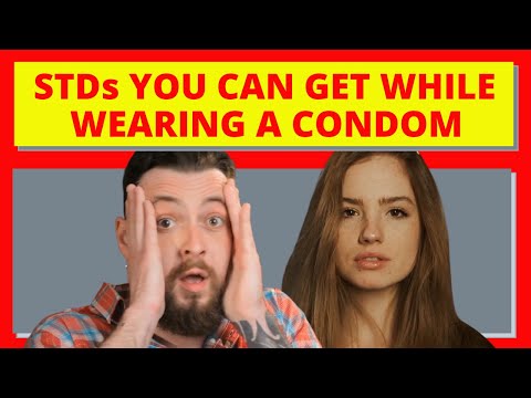 Chansen att få STD med kondom