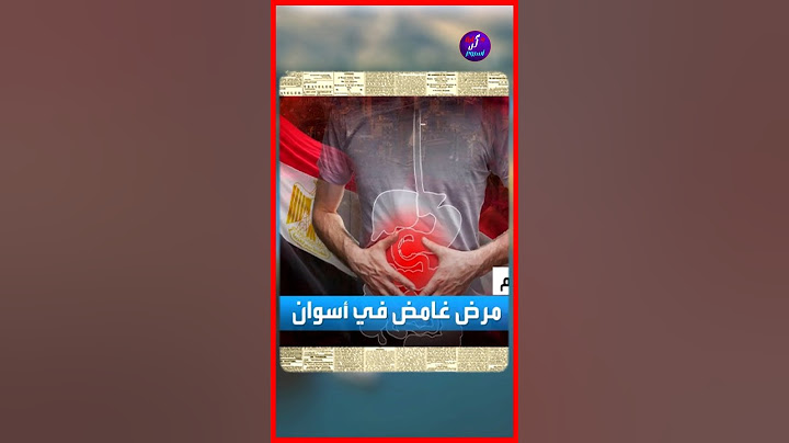 حكاية المرض الغامض الذي تفشى في محافظة أسوان #اسوان #مرض_غامض #الكوليرا #وزير_الصحة #مصر #shorts