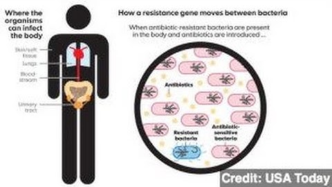 Superbug Spread Prompts CDC Concern