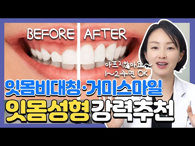 ()잇몸성형 이럴 때 하세요❗ 잇몸성형이 필요한 경우 알려드려요.