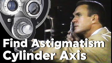 Astigmatism Axis Determination Cylinder with Retinoscopy Refraction with Phoropter Plus Cylinder